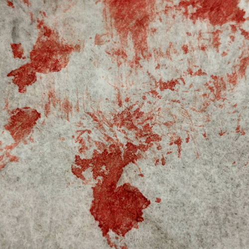 Acid Enema : Abatimiento Acid Enema : Abatimiento